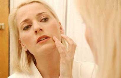 دلایل مهم جوش زدن در بزگسالی و درمان آن